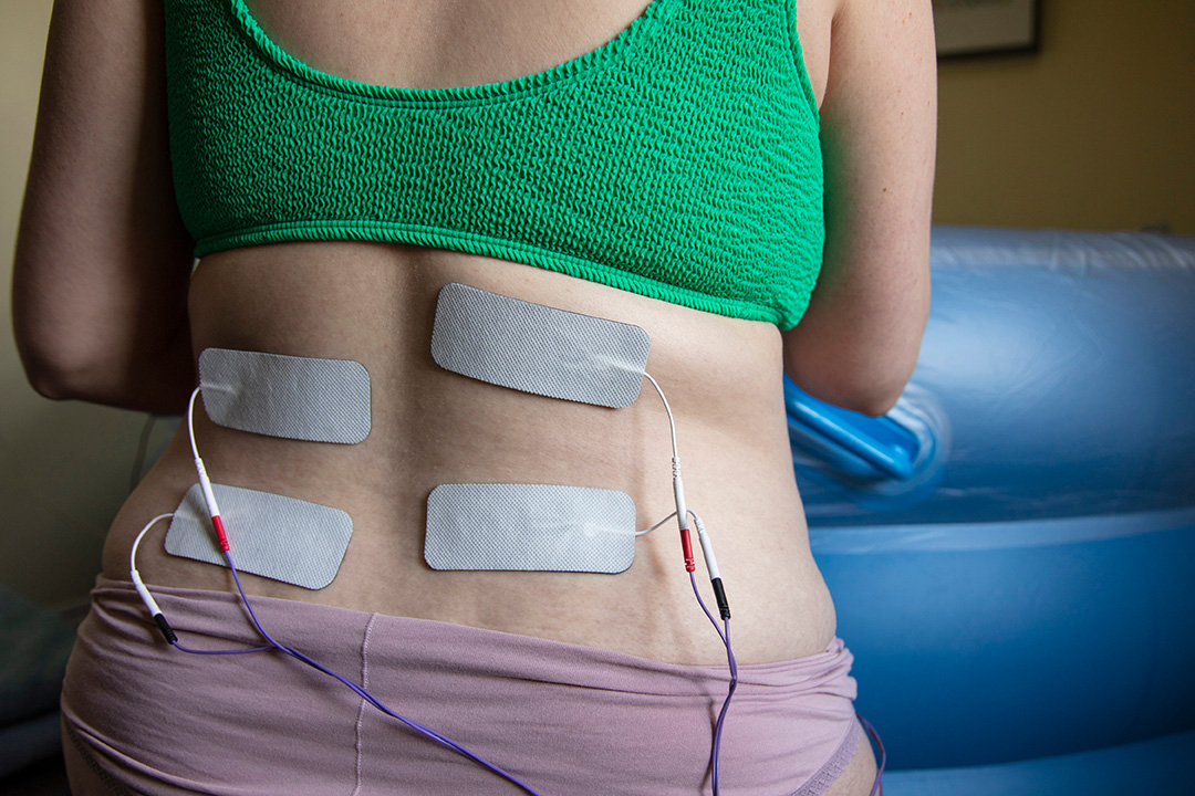 Transcutaneous Electrical Nerve Stimulation (TENS) for Pain Relief in Pregnant and Birthing Women